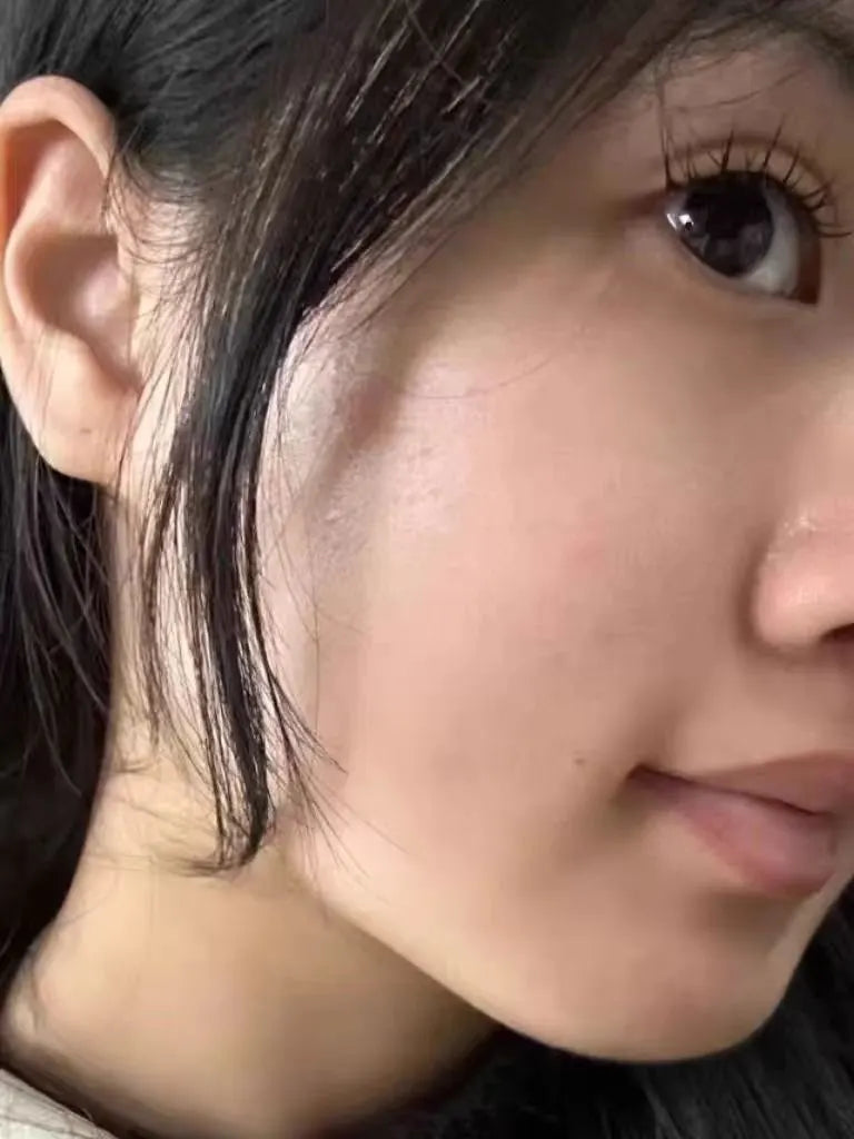 image comparison after