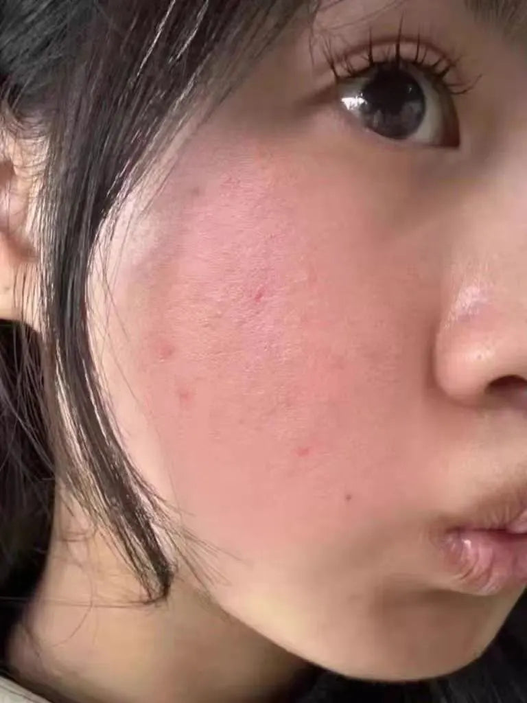 image comparison before